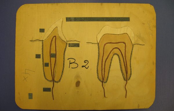 Bau der Zähne (Längsschnitt)