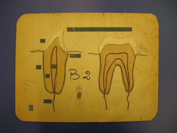 Bau der Zähne (Längsschnitt)
